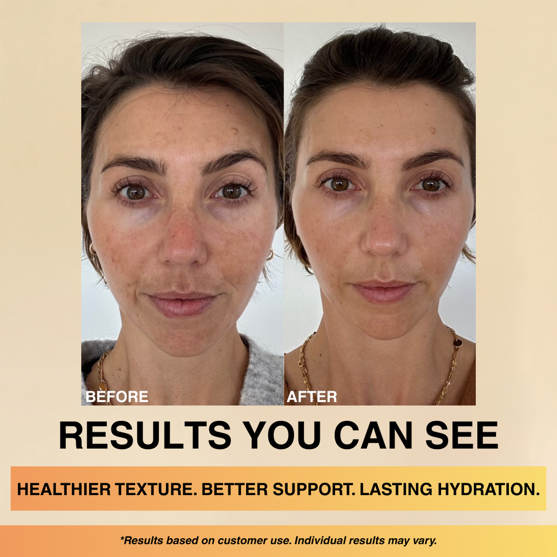 Crema facial Madeca de CARAMELA BEAUTY USA, crema anti envejecimiento y reafirmante para la piel.