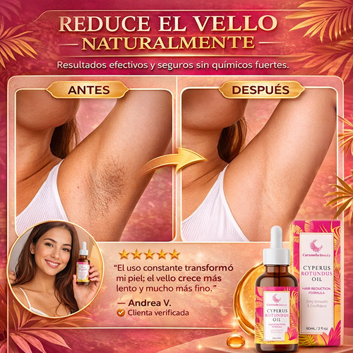 Caramela Beauty Cyperus Rotundus Oil: Menos vello, más suavidad.