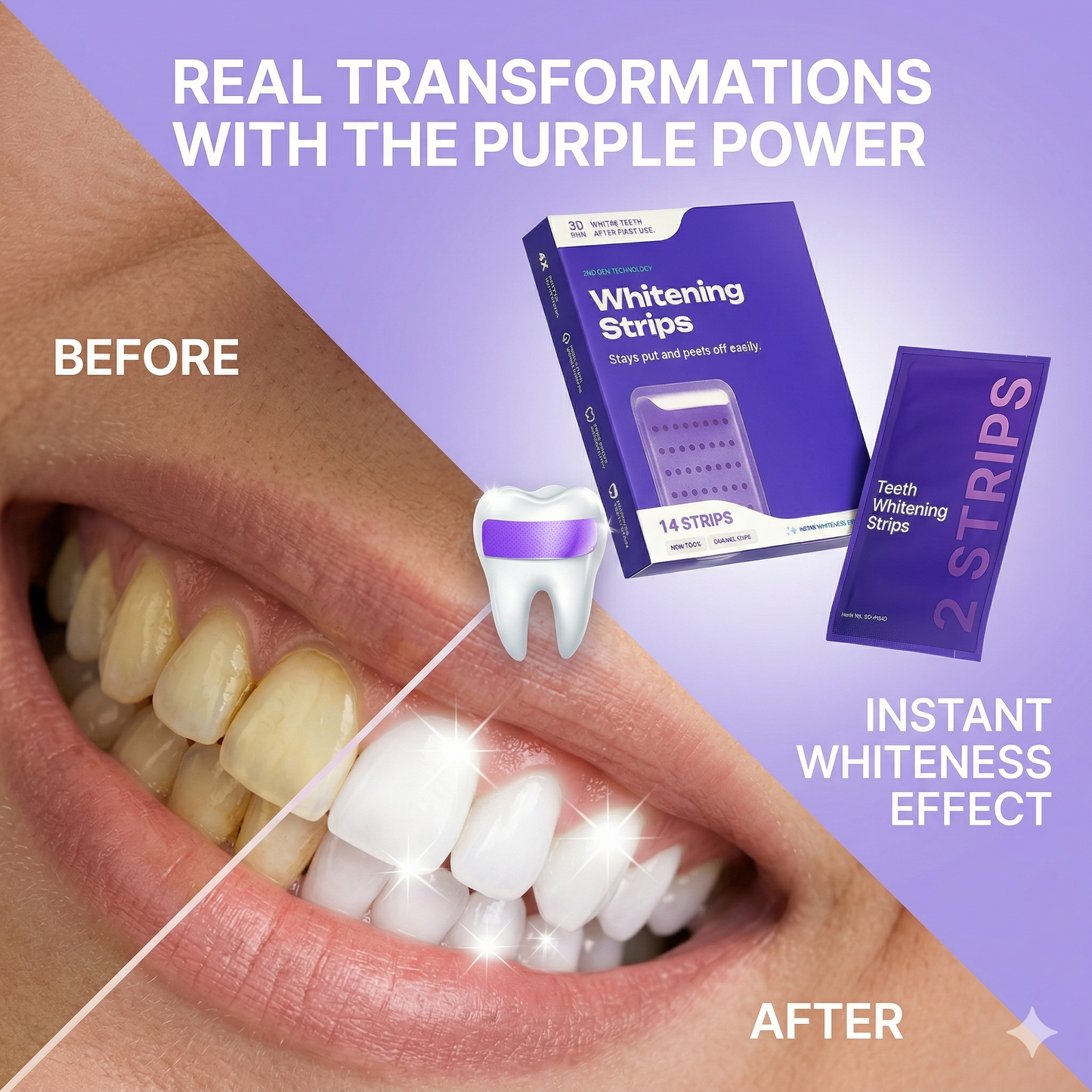 Whitening Strips That Brighten Your Smile in Just 30 Minutes